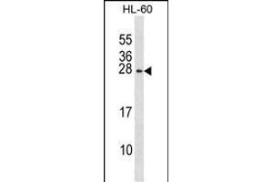 RGS2 Antibody (N-term) (ABIN1881749 and ABIN2839036) western blot analysis in HL-60 cell line lysates (35 μg/lane). (RGS2 抗体  (N-Term))