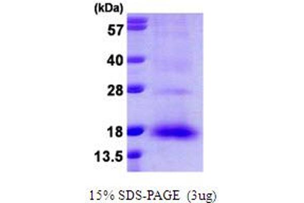 NXT1 Protein (AA 1-140) (His tag)