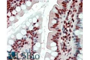 Immunohistochemistry (IHC) image for anti-Ewing Sarcoma Breakpoint Region 1 (EWSR1) (Internal Region) antibody (ABIN335135)