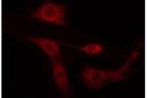 ABIN6274434 staining LOVO cells by IF/ICC. (ARID1B 抗体  (Internal Region))