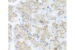 Immunohistochemistry of paraffin-embedded Human stomach using IL17A Polyclonal Antibody at dilution of 1:100 (40x lens).
