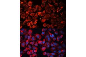 Immunofluorescence analysis of HeLa cells using CASP3 antibody. (Caspase 3 抗体  (AA 55-160))