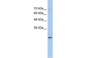 Western Blotting (WB) image for anti-Glutathione S-Transferase mu 1 (GSTM1) antibody (ABIN2462473) (GSTM1 抗体)