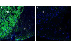 Expression of Neurofascin in rat spinal cord. (NFASC 抗体  (C-Term, Intracellular))