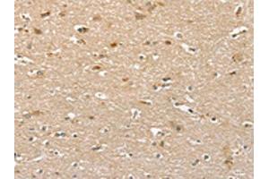 The image on the left is immunohistochemistry of paraffin-embedded Human brain tissue using ABIN7130610(PHLPP1 Antibody) at dilution 1/35, on the right is treated with fusion protein. (PHLPP1 抗体)