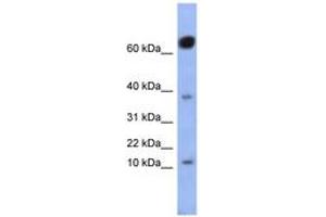 Image no. 1 for anti-NK6 Homeobox 3 (NKX6-3) (AA 71-120) antibody (ABIN6742923) (NK6 Homeobox 3 抗体  (AA 71-120))
