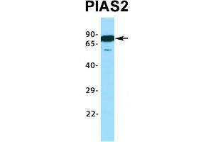 Host:  Rabbit  Target Name:  PIAS2  Sample Type:  721_B  Antibody Dilution:  1.