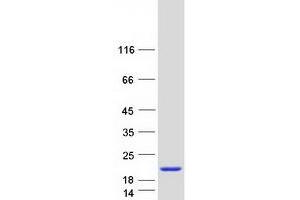 Western Blotting (WB) image for FK506 Binding Protein 2, 13kDa (FKBP2) (Transcript Variant 2) protein (Myc-DYKDDDDK Tag) (ABIN2721209)