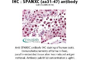 Image no. 1 for anti-SPANX Family, Member C (SPANXC) (AA 31-47) antibody (ABIN1739580) (SPANXC 抗体  (AA 31-47))