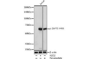 Western blot analysis of extracts of Jurkat cells, using Phospho-Z-Y493 antibody (ABIN3020534, ABIN3020535, ABIN3020536, ABIN1682145 and ABIN1682146) at 1:1000 dilution. (ZAP70 抗体  (pTyr493))