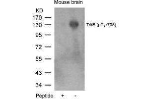 Image no. 1 for anti-Neurotrophic Tyrosine Kinase, Receptor, Type 2 (NTRK2) (pTyr705) antibody (ABIN319265)