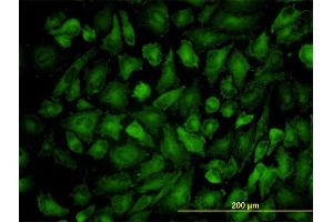 Immunofluorescence of monoclonal antibody to VCL on HeLa cell. (Vinculin 抗体  (AA 1-1066))