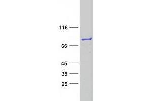 Western Blotting (WB) image for Epithelial Splicing Regulatory Protein 2 (ESRP2) protein (Myc-DYKDDDDK Tag) (ABIN2720523)