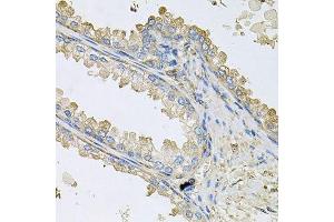 Immunohistochemistry of paraffin-embedded human prostate using PPIC antibody. (PPIC 抗体  (AA 23-212))