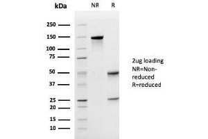 SDS-PAGE Analysis Purified Uroplakin 1A Mouse Monoclonal Antibody (UPK1A/2925). (UPK1A 抗体  (AA 114-173))