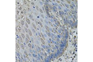 Immunohistochemistry of paraffin-embedded human esophagus using IL1A antibody (ABIN6291332) at dilution of 1:100 (40x lens). (IL1A 抗体)