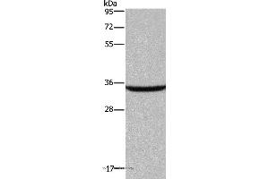 Western blot analysis of Human fetal brain tissue, using DKK3 Polyclonal Antibody at dilution of 1:200 (DKK3 抗体)