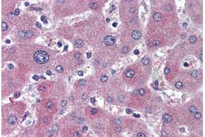 Immunohistochemistry (Paraffin-embedded Sections) (IHC (p)) image for anti-ATP-Binding Cassette, Sub-Family B (MDR/TAP), Member 11 (ABCB11) (AA 705-718) antibody (ABIN305775)