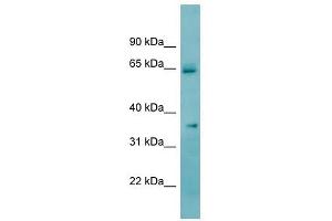 KHK antibody used at 1 ug/ml to detect target protein. (Ketohexokinase 抗体)