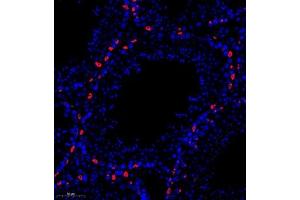 Immunofluorescence of paraffin embedded mouse testis using PP4R2 (ABIN7075284) at dilution of 1:1000 (280x lens) (PPP4R2 抗体)