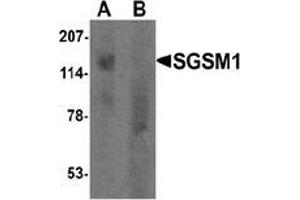 Western blot analysis of SGSM1 in human cerebellum tissue lysate with SGSM1 Antibody  at 1 μg/ml in (A) the absence and (B) the presence of blocking peptide. (SGSM1 抗体  (Middle Region))