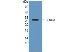 Western Blotting (WB) image for anti-ATP-Binding Cassette, Sub-Family C (CFTR/MRP), Member 2 (ABCC2) (AA 1300-1534) antibody (ABIN7441076)