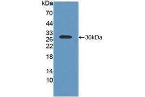 Detection of Recombinant ABCC2, Human using Polyclonal Antibody to ATP Binding Cassette Transporter C2 (ABCC2) (ABCC2 抗体  (AA 1300-1534))