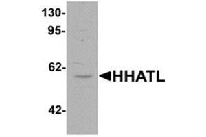 Western blot analysis of HHATL in 3T3 cell lysate with HHATL antibody at 1 ug/mL. (HHATL 抗体  (N-Term))