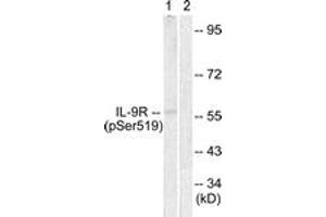 Western blot analysis of extracts from HuvEc cells, using IL-9R (Phospho-Ser519) Antibody. (IL9 Receptor 抗体  (pSer519))