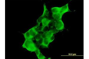 Immunofluorescence of purified MaxPab antibody to DTNA on 293 cell. (DTNA 抗体  (AA 1-371))