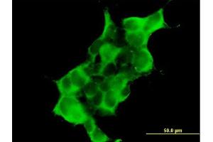 Immunofluorescence of purified MaxPab antibody to DTNA on 293 cell.