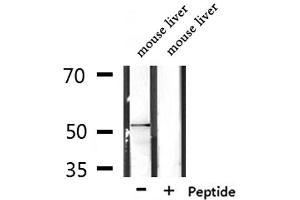 Western blot analysis of extracts from mouse liver, using RASGEF1C Antibody. (RASGEF1C 抗体  (Internal Region))