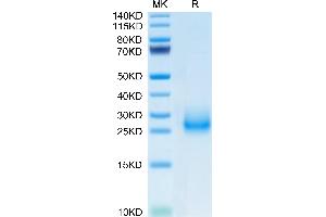 SDS-PAGE (SDS) image for CD7 (CD7) (AA 24-150) protein (His tag) (ABIN7274241)