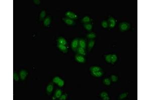 Immunofluorescent analysis of HepG2 cells using ABIN7145825 at dilution of 1:100 and Alexa Fluor 488-congugated AffiniPure Goat Anti-Rabbit IgG(H+L) (BRD9 抗体  (AA 338-597))