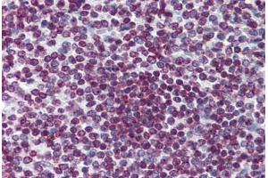 Human Spleen: Formalin-Fixed, Paraffin-Embedded (FFPE) (FOXO3 抗体  (AA 361-460))