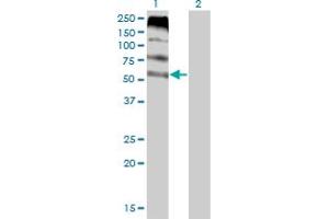 Western Blot analysis of FLVCR expression in transfected 293T cell line by FLVCR monoclonal antibody (M05), clone 4B2. (FLVCR 抗体  (AA 1-83))