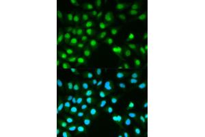 Immunofluorescence analysis of HeLa cell using PPP3CA antibody. (PPP3CA 抗体)