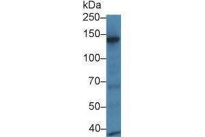 Detection of RBP3 in Mouse Eye lysate using Polyclonal Antibody to Retinol Binding Protein 3, Interstitial (RBP3) (RBP3 抗体  (AA 1027-1229))