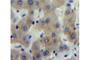 Used in DAB staining on fromalin fixed paraffin-embedded Liver tissue (FCN1 抗体  (AA 25-317))