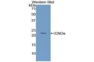 Western blot analysis of the recombinant protein. (PON1 抗体  (AA 2-186))