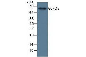 Detection of MMP19 in Human Serum using Polyclonal Antibody to Matrix Metalloproteinase 19 (MMP19) (MMP19 抗体  (AA 98-508))