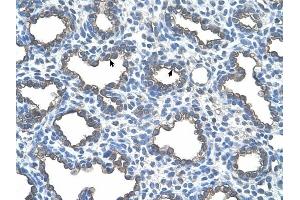 UBE2D2 antibody was used for immunohistochemistry at a concentration of 4-8 ug/ml to stain Alveolar cells (arrows) in Human Lung.
