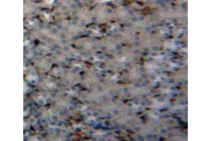 Immunohistochemistry (IHC) image for anti-Peptidylprolyl Cis/trans Isomerase, NIMA-Interacting 1 (PIN1) (AA 2-165) antibody (ABIN1078430)