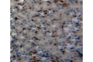Used in DAB staining on fromalin fixed paraffin-embedded kidney tissue (PIN1 抗体  (AA 2-165))