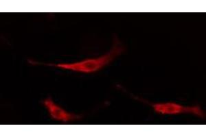 ABIN6267670 staining NIH-3T3 cells by IF/ICC. (TRKB 抗体  (pTyr706))