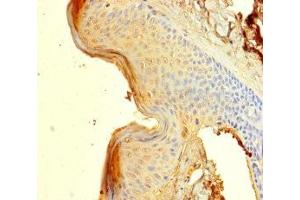Immunohistochemistry of paraffin-embedded human skin tissue using ABIN7148585 at dilution of 1:100