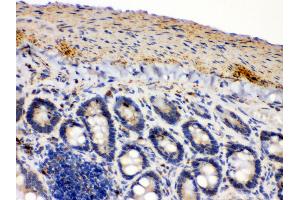 Anti- IDH2 Picoband antibody, IHC(P) IHC(P): Mouse Intestine Tissue