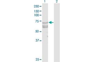 Western Blotting (WB) image for anti-Tumor Necrosis Factor Receptor Superfamily, Member 21 (TNFRSF21) (AA 1-655) antibody (ABIN525916)