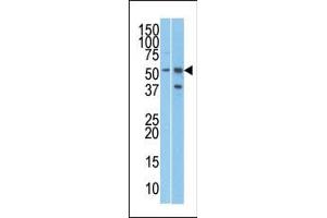 The anti-R Pab (ABIN388684 and ABIN2838672) is used in Western blot to detect R in T47D (left) and Jurkat (right) cell line lysates. (URI1 抗体  (C-Term))