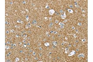 The image on the left is immunohistochemistry of paraffin-embedded Human brain tissue using ABIN7193008(VAMP2 Antibody) at dilution 1/20, on the right is treated with synthetic peptide. (VAMP2 抗体)